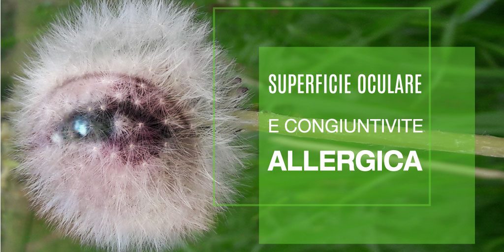 Congiuntivite-Allergica-Professione-Oculista ECM FAD Medical Evidence