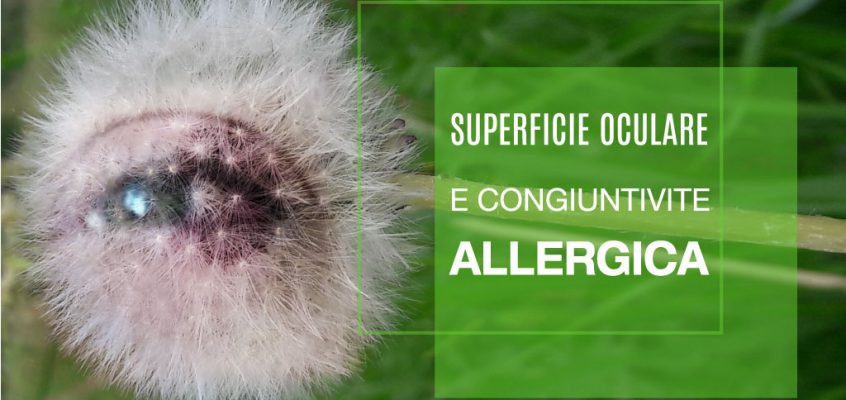 Superficie Oculare e Congiuntivite Allergica