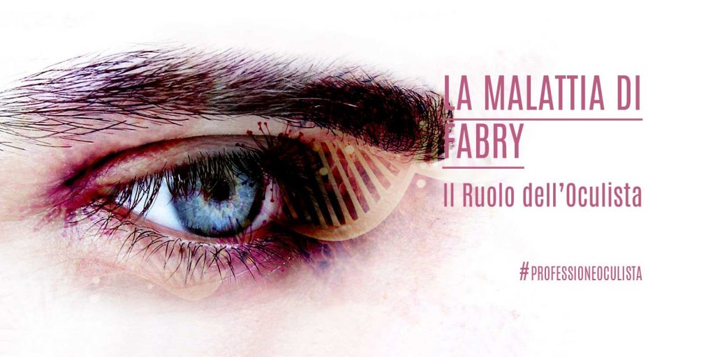 Professione-Oculista-Malattia-di-Fabry-ruolo-oculista-ECM-FAD