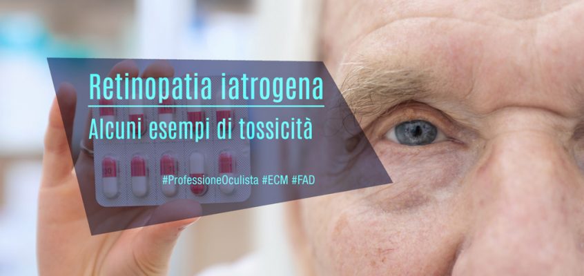 Retinopatia iatrogena: alcuni esempi di tossicità
