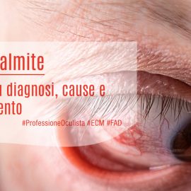 Endoftalmite: focus su diagnosi, cause e trattamento. Il ruolo dell’Oculista