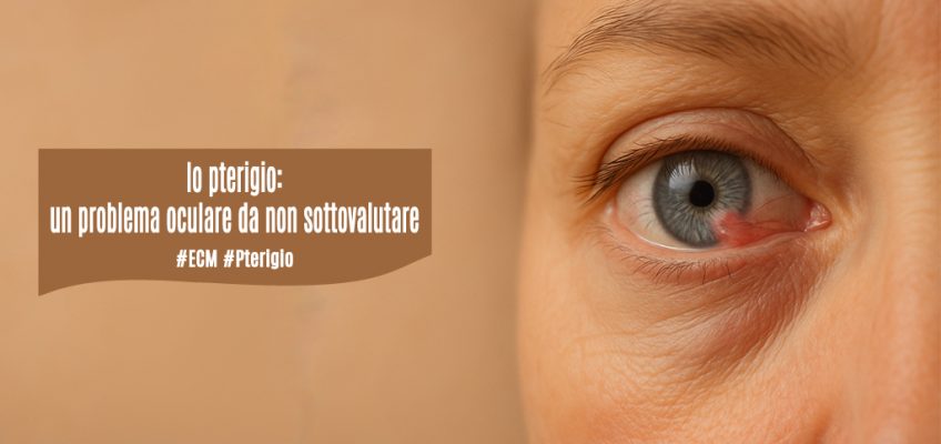 pterigio-problema oculare da non sottovalutare-ecm-professione oculista